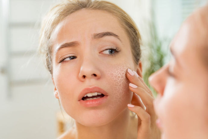 Dry Skin vs Dehydrated Skin-Understanding the Difference by Lynn Jenkins